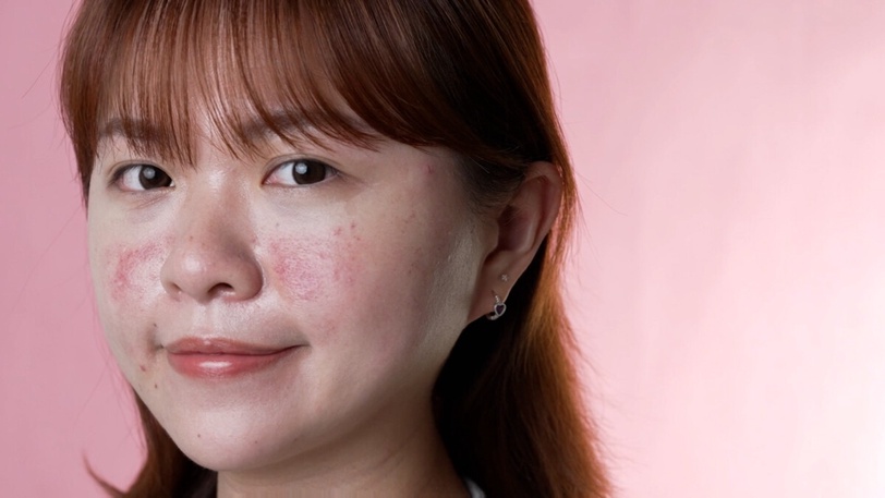 美容進廠後的天選防曬！B編實測打完雷射用這瓶防曬，預防反黑無死角，安心度過修復期