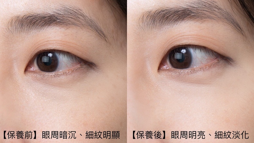 你的眼皮鬆了嗎？看起來很累其實是「眼周鬆弛」！資生堂A醇ACE眼霜成分解析實測一次看