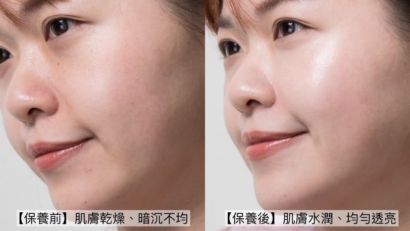 POLA頂級美白無痛入手！全新「擊速煥白淨透化妝水」2500元擁有！敏弱肌淡斑提亮無負擔
