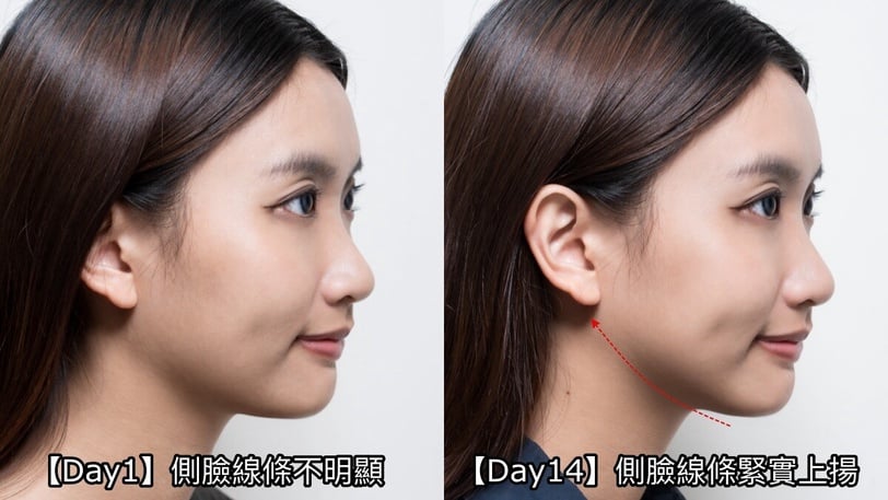 資生堂 超級精華 液態電音雙波