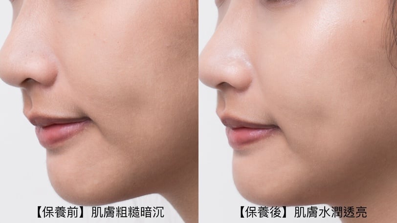 不再無效保養!皮膚科醫師解答膚況不穩,吸收力與角質養護,碳酸*¹深導科技突破保養極限
