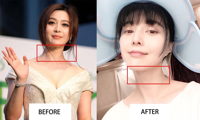 頸紋淡化3重點 3技巧 這幾款淡化頸紋霜被網友推爆 Beauty美人圈