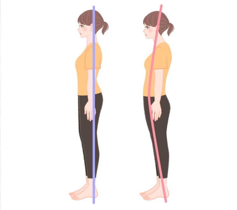 如果你不胖卻小肚子突出、躺在地上腰不能貼地、站久了還容易腰疼，那你就很有可能有骨盆前傾的問題。下圖左為正常，下圖右為有骨盆前傾的狀況。