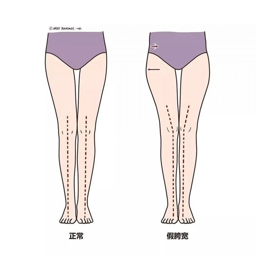 亞洲女生臀部位置普遍較低、旁邊還常常多出兩塊，這就是所謂的「假胯寬」。