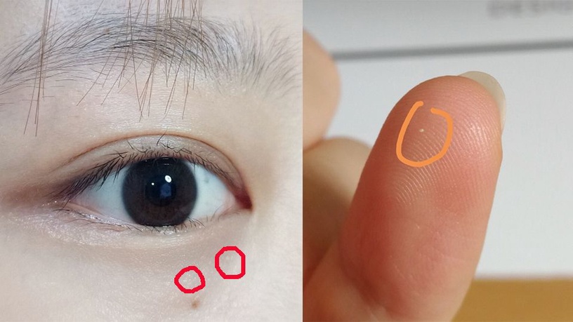 一顆顆的脂肪粒實在煩人!5招避免眼周脂肪粒的保養關鍵秘訣解鎖!