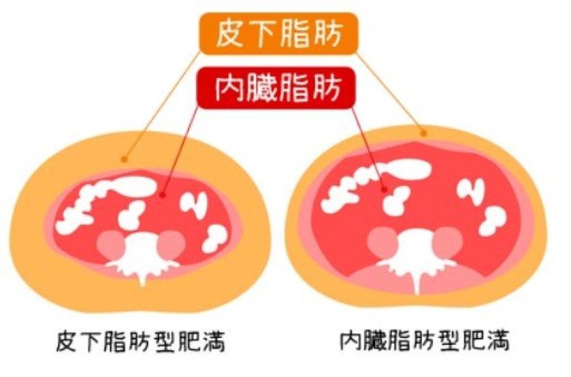 四肢瘦肚子大?想瘦肚子,請先擊退「內臟脂肪」!