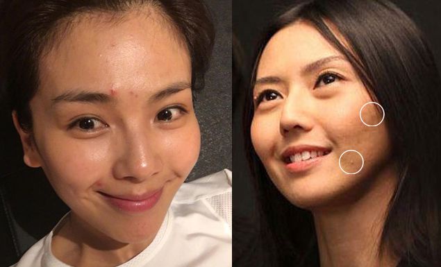 你的臉就是行走版的紅豆冰?4款網友力推的淡疤救星!