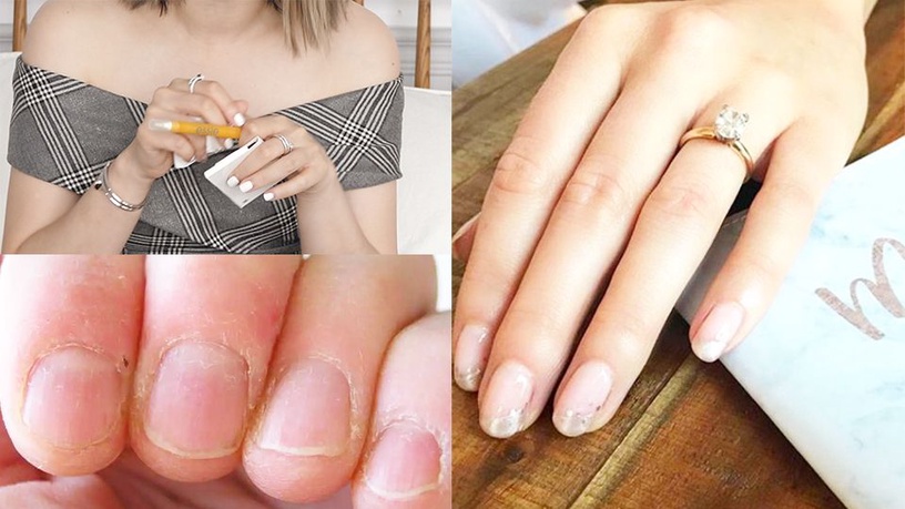 指甲旁邊都會翹起來?這幾款指緣油,凱文老師、眾女星超愛用!