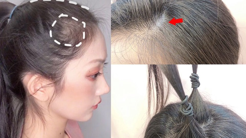 微禿女孩的「偽豐髮」馬尾技巧!兩招技巧,讓禿禿的那塊消失!