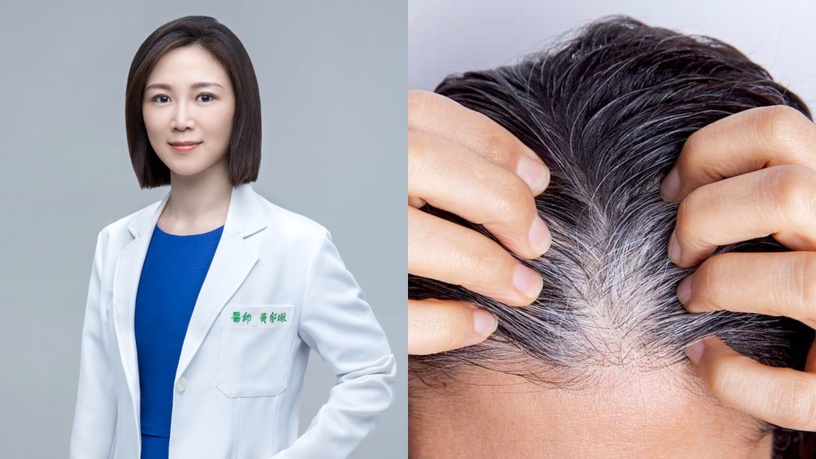 撥頭髮也不再擔心白髮被看見!髮根不用再補染,照樣烏黑年輕,連皮膚科醫師都在用!