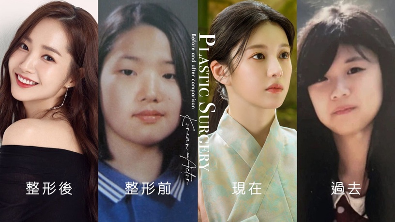 《還魂2》高允貞遭誣陷整容! 韓星「整形前後對比」,朴敏英最成功,薛仁雅本來就很美