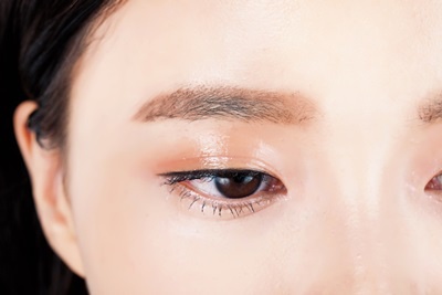 ng2 没角度的直眉