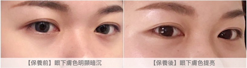 雅詩蘭黛保養 松露小金瓶 速效亮眼瑜伽