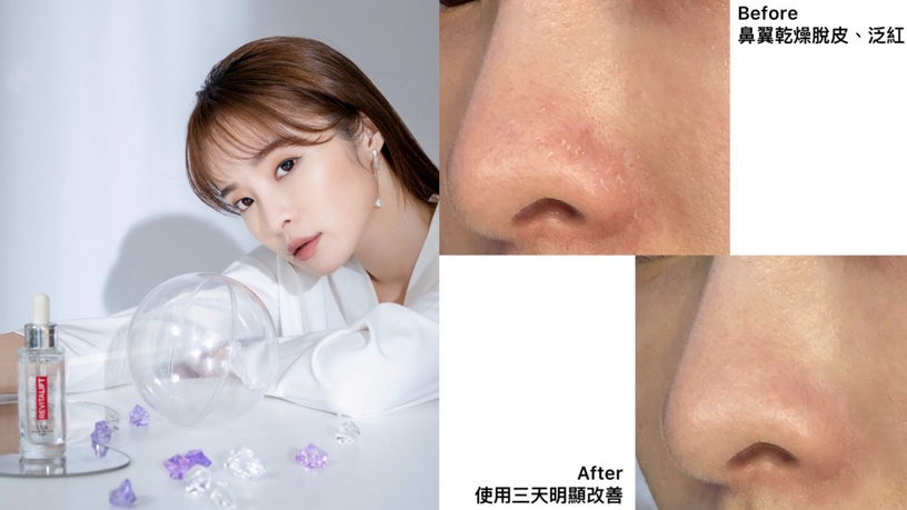 保濕不想努力了?你玻尿酸根本沒擦對!「10倍濃度超級玻尿酸精華」滴滴衝破爆水天花板