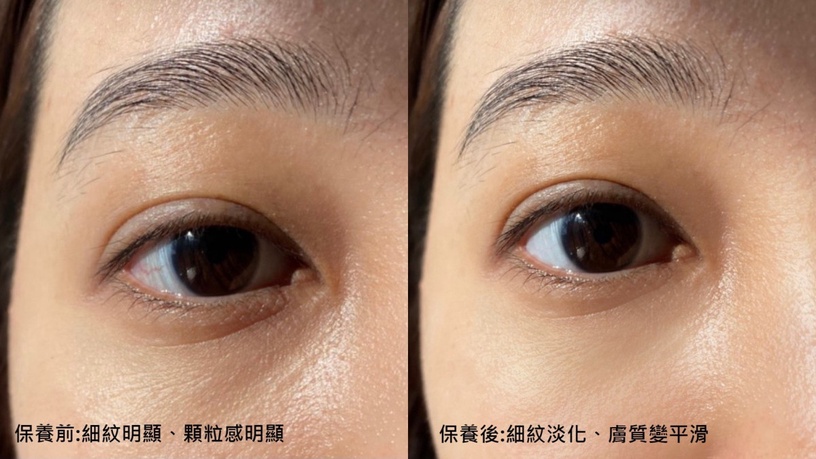 編輯親測變大小眼嚇歪!按摩1分鐘、雙眸兩倍年輕,以前在眼霜浪費的錢,用它補回來!