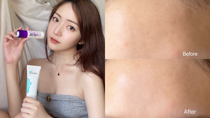 德卡保養品 淨透系列 淨透15調理露 淨透水凝凍 dermalogicatw breakoutclearingbooster coolingaquajelly