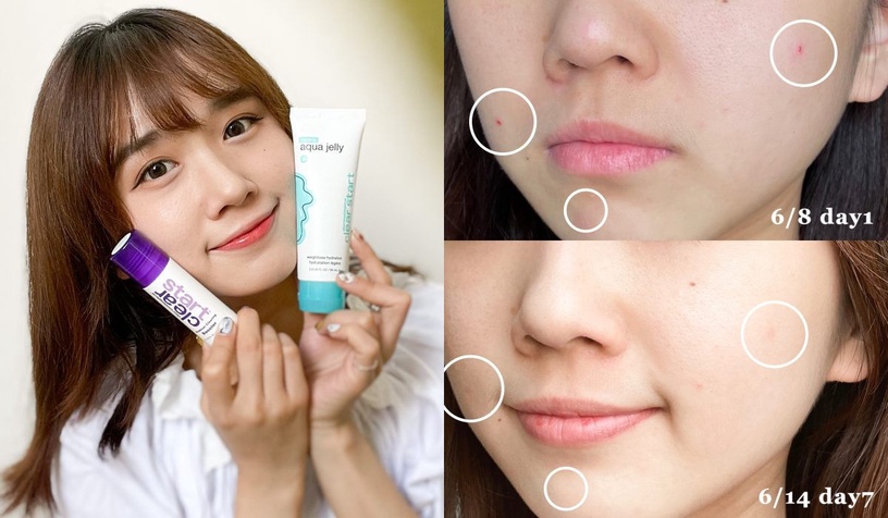 德卡保養品 淨透系列 淨透15調理露 淨透水凝凍 dermalogicatw breakoutclearingbooster coolingaquajelly