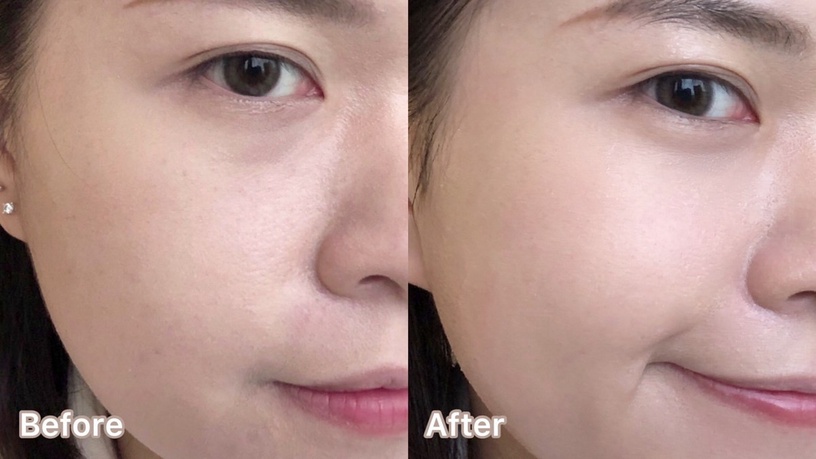 OLAY 小白瓶面膜 小白瓶 15分鐘居家美白SPA