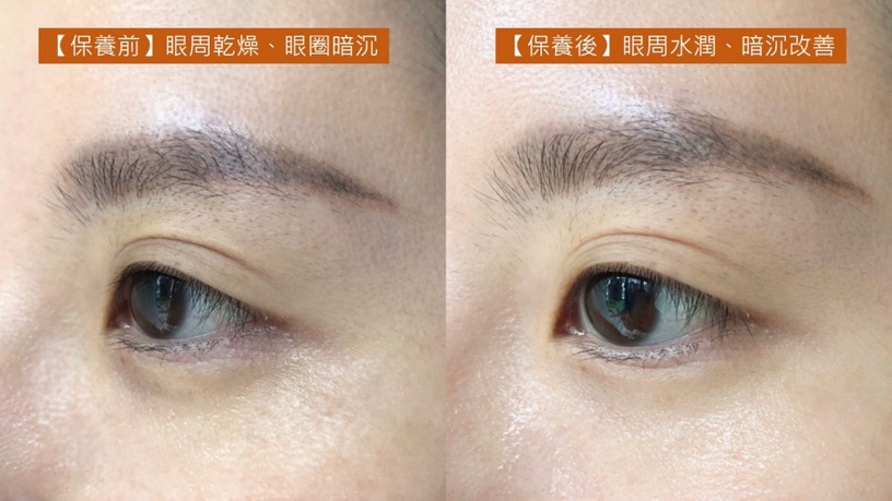 CLARINS 克蘭詩 光圈眼萃 黃金亮眼萃 年輕黃金瓶 黃金雙激萃