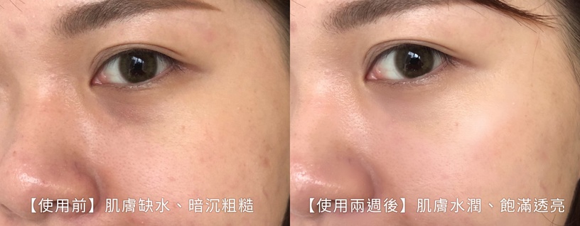 地表最強讚美「少女感」!贏在雙頰緊緻飽滿水玉光!保濕緊實,週年慶必收澎彈亮金三角