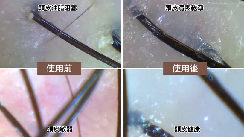 盤點「行走費洛蒙」巔峰&走鐘照,髮量定生死!森歐黎漾“髮界小棕瓶”養健髮續航魅力
