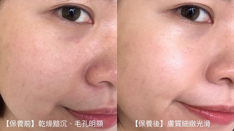 小粉金 抗老精華 逆齡新寵 超能精華 雅芳 avontaiwan shopavon