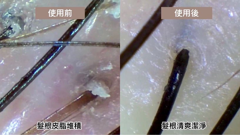 控油洗髮精推薦 編輯盲測 醋養髮