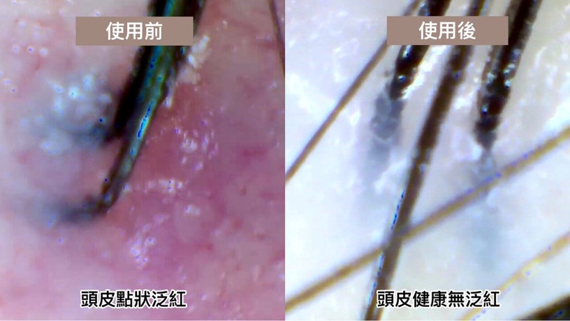 控油洗髮精推薦 編輯盲測 醋養髮