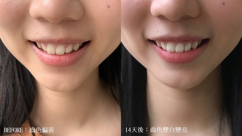 牙齒美白 好市多 美白牙貼 Crest美白牙貼