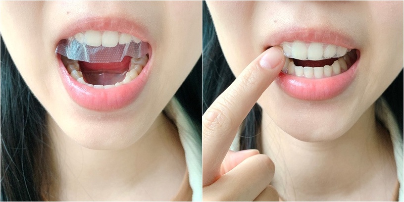 牙齒美白 好市多 美白牙貼 Crest美白牙貼