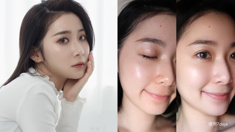 Neogence 霓淨思 杏仁酸透亮煥膚精華 煥膚小紅瓶 新一代無痛煥膚權威 杏仁酸瞬效淨痘無瑕精華 24h極效對抗痘痘 精準改善油痘瑕疵