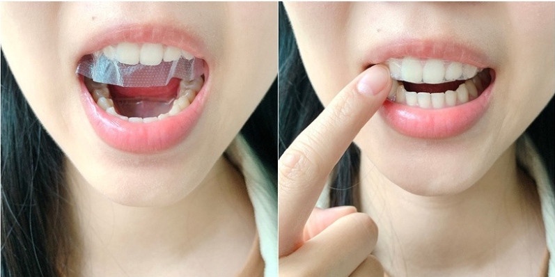好市多 Crest美白牙貼 牙齒美白