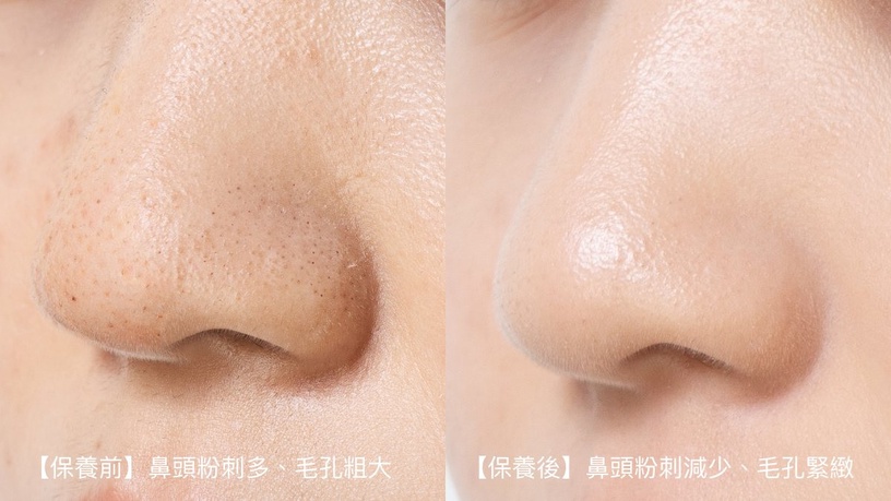 理膚寶水 三酸煥膚瓶 七夕約會攻略 淨痘無瑕極效精華DUO 台灣皮膚科醫師推薦NO1