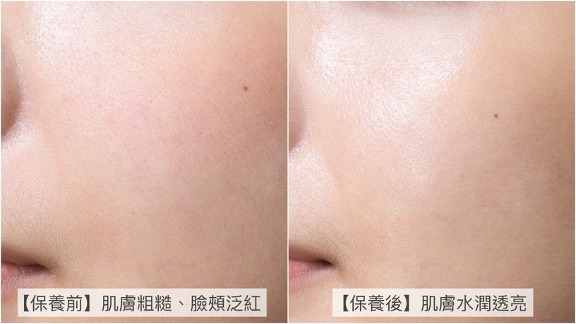 dprogram d敏急救霜 敏弱肌乳霜 保濕乳霜 換季保養