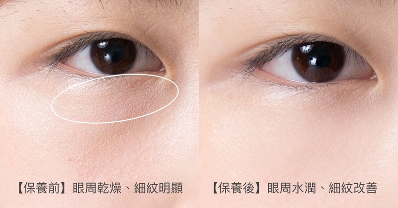 擦眼霜不再浪費錢!資生堂全新「小紅電眼精華」有感彈嫩亮Eye放電,聯手小紅瓶10倍年輕