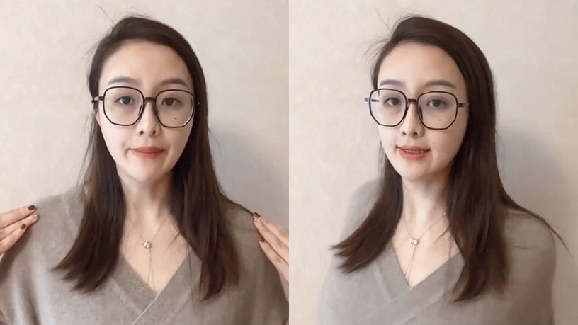 中庭肌肉一垂老10歲!整形醫生分享「假笑運動法」,顴骨拉提有感、整張臉變膨潤緊緻