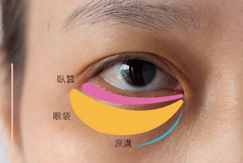 眼袋淚溝能消除!保養老師按摩3技巧消除眼袋淚溝,免手術細紋、浮腫都消滅!
