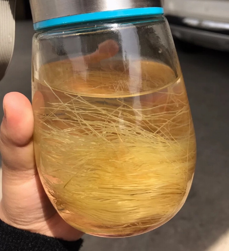 消除水腫不虛胖!營養師解析水腫原因&五種必吃消水腫食材,吃它還能美白!