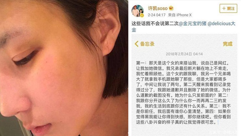 捲入桃色風波的陸劇男星2:許凱