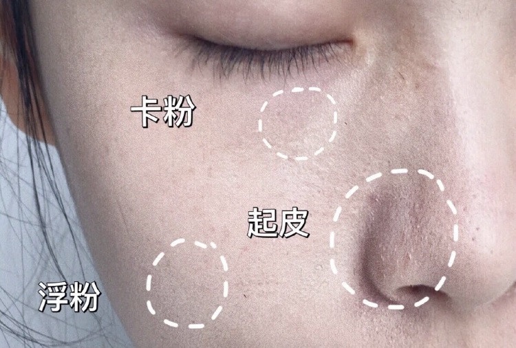 彩妝師瑕疵肌「無瑕輕薄底妝」畫法!脫皮/痘痘/毛孔都有解,新手底妝步驟這樣做