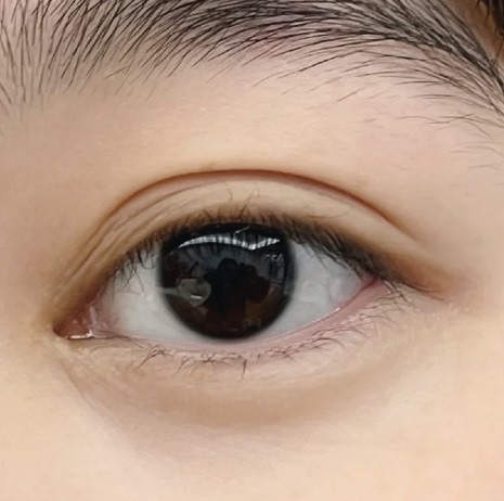 雙眼皮貼怎麼貼?內雙/單眼皮「萬能雙眼皮貼公式」,矯正眼型、貼完像媽生雙眼皮