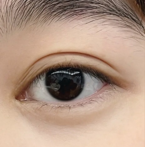 雙眼皮貼怎麼貼?內雙/單眼皮「萬能雙眼皮貼公式」,矯正眼型、貼完像媽生雙眼皮