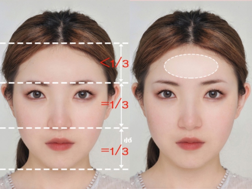 露額頭髮型、稀疏髮必看!不同臉型「額頭修容」技巧,拯救高額頭、大腦門、偽禿感