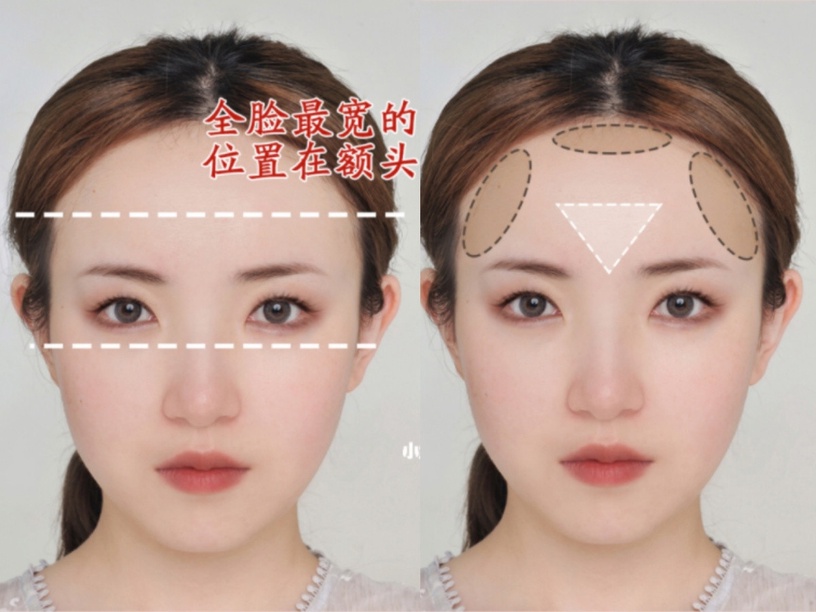 露額頭髮型、稀疏髮必看!不同臉型「額頭修容」技巧,拯救高額頭、大腦門、偽禿感