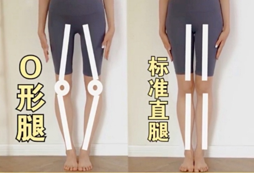居家矯正腿型、瘦腿必學!教練親授矯正O型腿、XO型腿運動,躺著就能縮胯瘦腿
