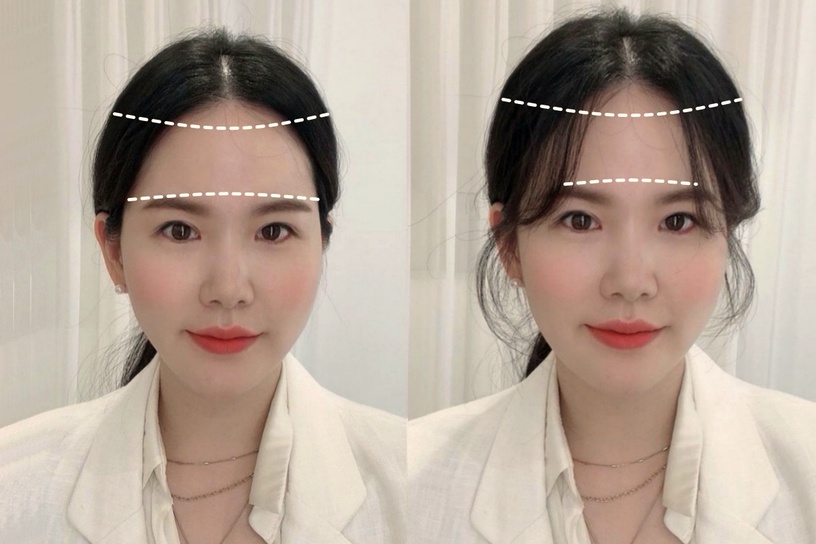 臉包頭/頭包臉怎麼分?髮型師公開不同臉型「小臉綁髮」重點,顱頂、兩側蓬鬆是關鍵