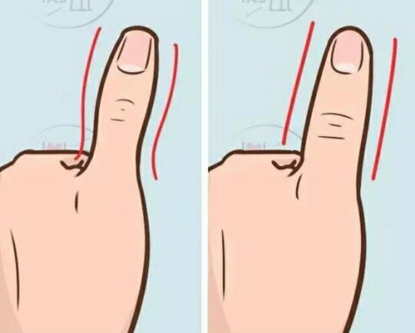 你容易發福嗎?超神準「易胖體質測驗」5大特徵你中了幾個,快用這三招找回瘦身基因