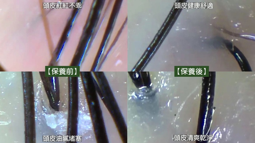 顏值防塌靠養髮!【INNEX植萃賦活】絕地反擊頂上危機,迎接夏天「頭皮頭髮不分手 」!