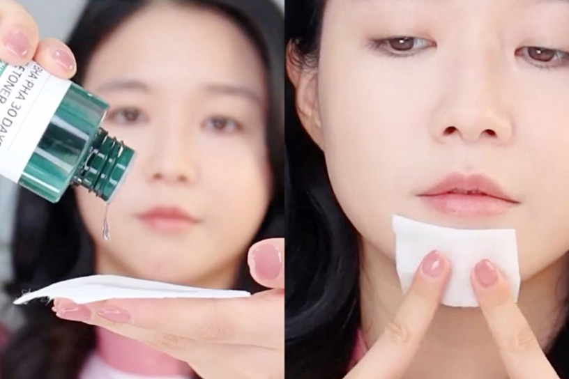 皮膚科醫生正確擠痘痘、擠粉刺技巧!擠痘方向及手法是關鍵,痘痘好的快、更不易留疤