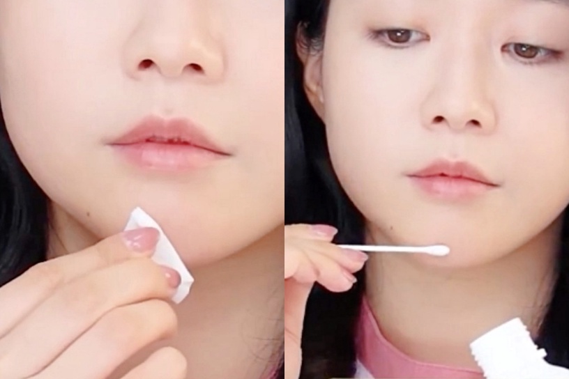 皮膚科醫生正確擠痘痘、擠粉刺技巧!擠痘方向及手法是關鍵,痘痘好的快、更不易留疤